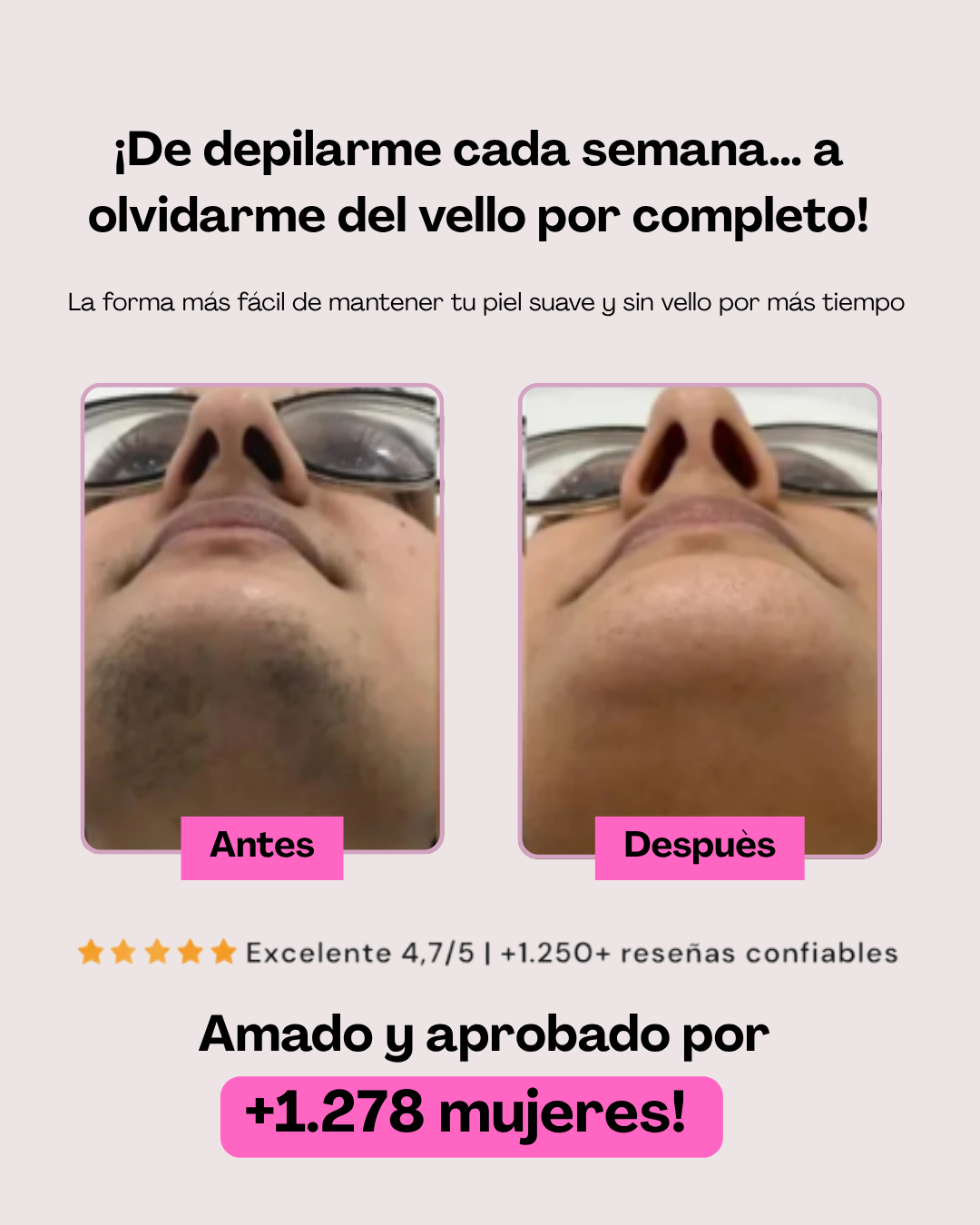 Aceite de Cyperus Rotundus