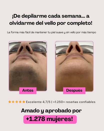 Aceite de Cyperus Rotundus