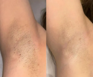 Julieta P., 38 años